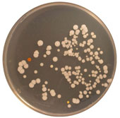 Detecting bacterial 'forest' in human navel