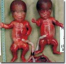 Detecting birth defects from the seventh week