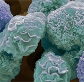 Detecting breakthroughs on cancer-causing mechanism
