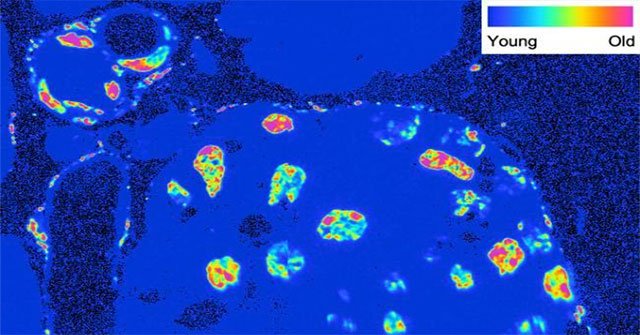 Detecting cells with age equal to the age of the body