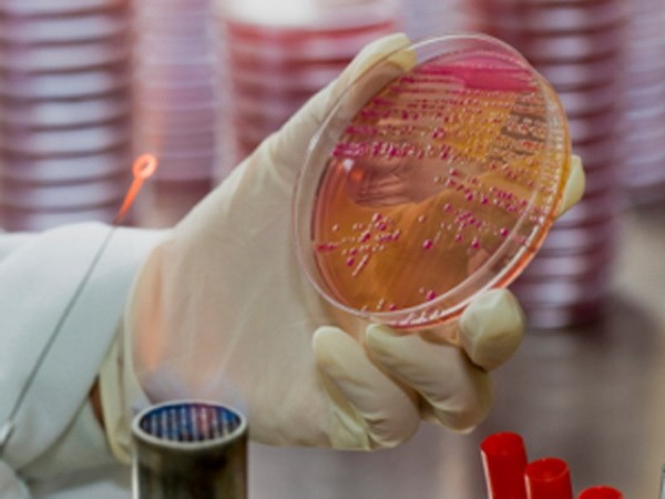 Detecting deadly drug-resistant virus in Australia
