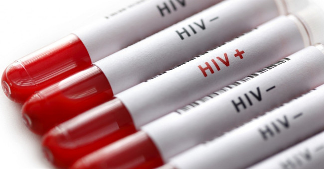 Detecting drugs that treat lung cancer can kill HIV cells