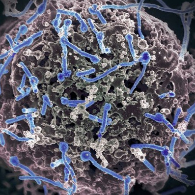Detecting Ebola virus in spermatozoa who got sick 9 months earlier