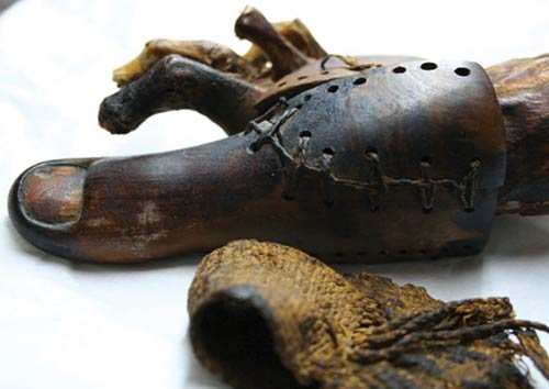 Detecting fake toes in an Egyptian mummy