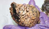 Detecting human brain preserved in mud layer for 2,600 years