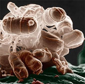 Detecting intestinal bacteria helps to lose weight