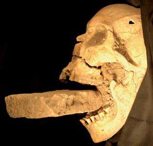 Detecting medieval skulls