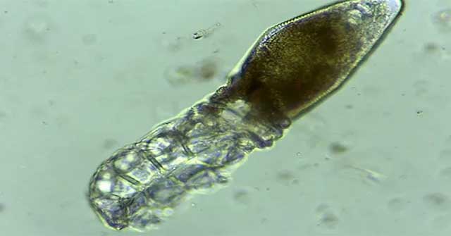 Detecting microscopic parasites on human face