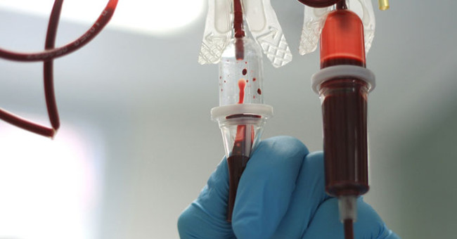 Detecting the 'brother' virus strain of hepatitis C virus