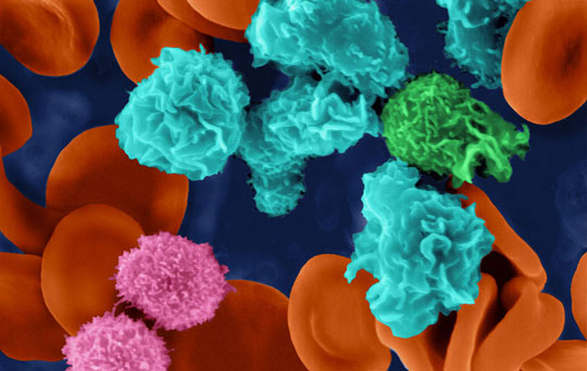 Detecting the origin of immune cells in the brain