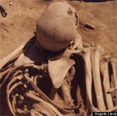 Detecting the remains of cancer patients 4,500 years ago