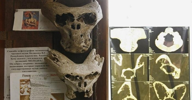 Detecting two mysterious skulls of aliens