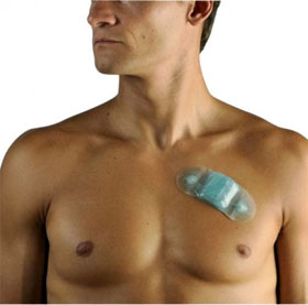 Detection of arrhythmias by tiny devices