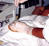 Detection of fetal malformations through prenatal diagnosis