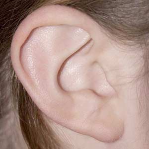 Detection of gene variants causing hearing loss