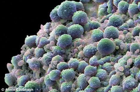 Detection of genes capable of controlling cancer cells