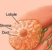 Detection of genetic modification factors for breast cancer
