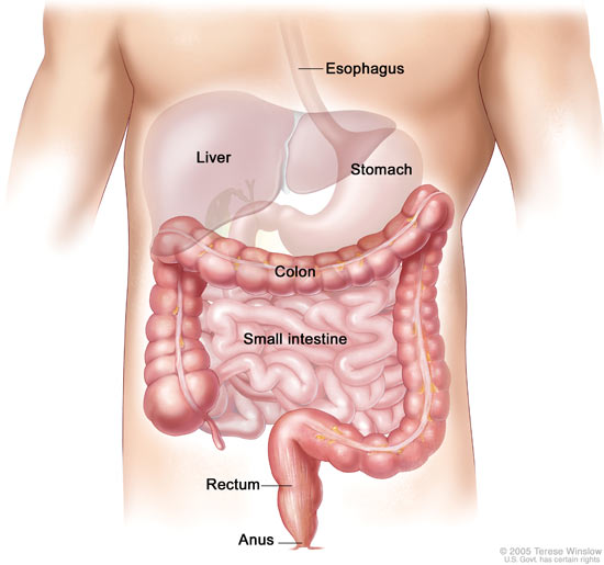 Detection of genetic risk of bowel cancer