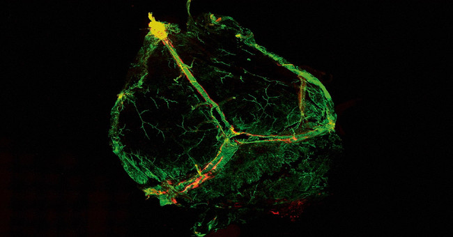 Detection of lymphatic vessels that have never been seen in the human brain