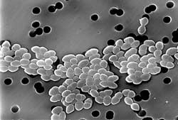 Detection of new antibiotics inhibits resistant bacteria
