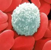Detection of risk of leukemia due to low dose radiation