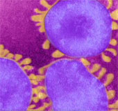 Detection of SARS-like virus in Spain