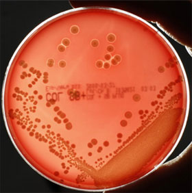 Detection of weaknesses of drug resistance