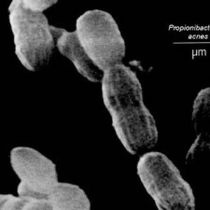 Detects bacteria that cause infections