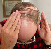 Detects genes that regenerate hair and skin