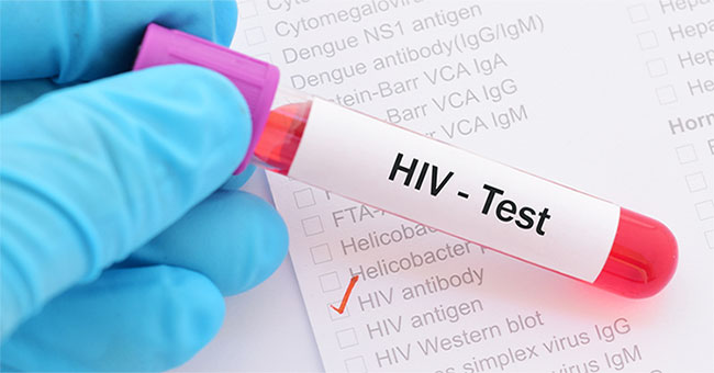 Detects mechanisms that help cure HIV in the human brain