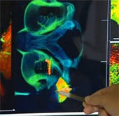 Develop brain imaging technology for cochlear implant patients