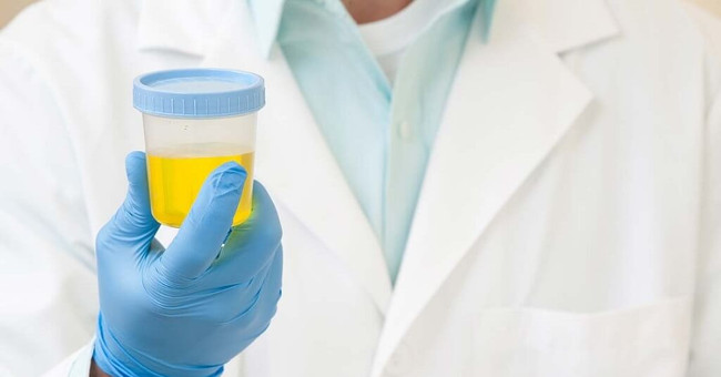 Develop methods to store blood and urine without chilling