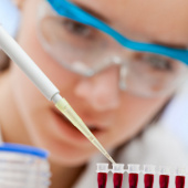 Development of kidney tissue from stem cells