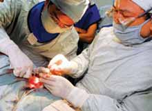 Device ICD saves millions of people with heart disease