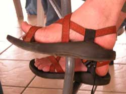 Diabetic foot ulcers can easily lead to amputation