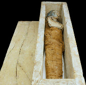 Diagnosis of 4,000-year-old mummy