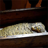 Diagnosis of appendicitis for mummies 2100 years old