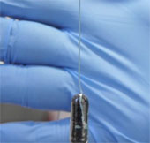 Diagnosis of esophageal cancer: Sponge capsule instead of endoscopy