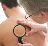Diagnosis of the disease through the skin