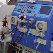 Dialysis is faster and safer with the new method