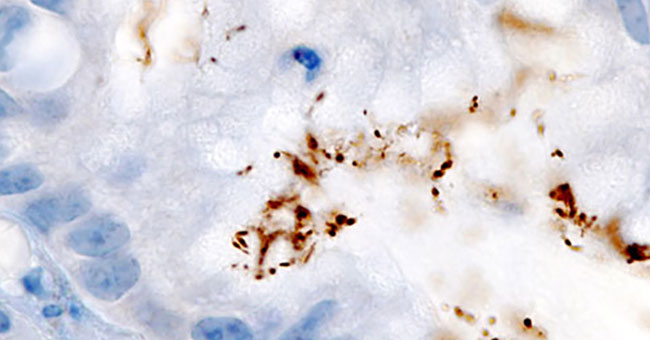 Differences between viruses, bacteria and parasites