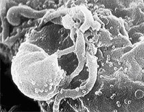 Direct movie recording when the HIV virus is born