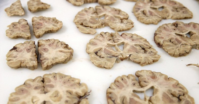Discover Britain's largest brain bank
