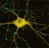 Discover how the brain creates memories