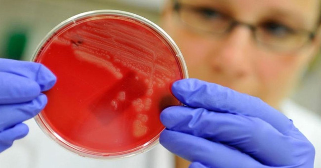 Discover more cases of antibiotic-resistant viruses in the United States