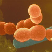 Discover more types of beneficial bacteria in the intestinal tract