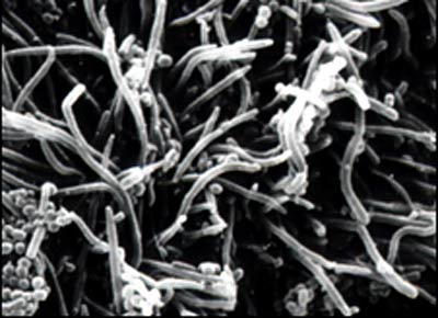 Discover new bacteria that cause dental disease