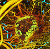 Discover the inner workings of cancer