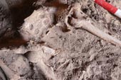 Discover the skeleton of the first human breast cancer patient