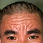 Discover the world's first strange skin case